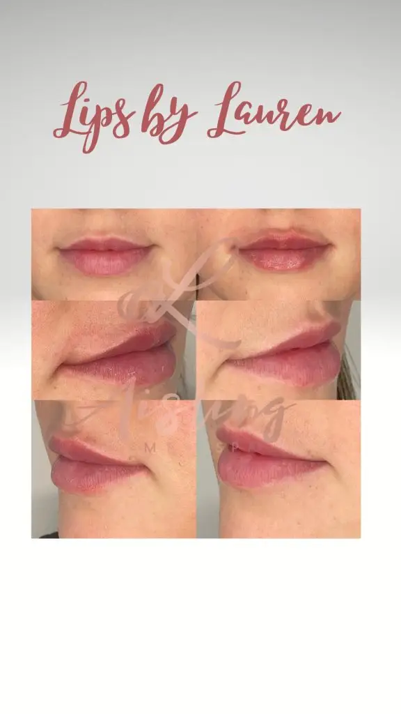 Lip enhancement results displayed in a grid layout.