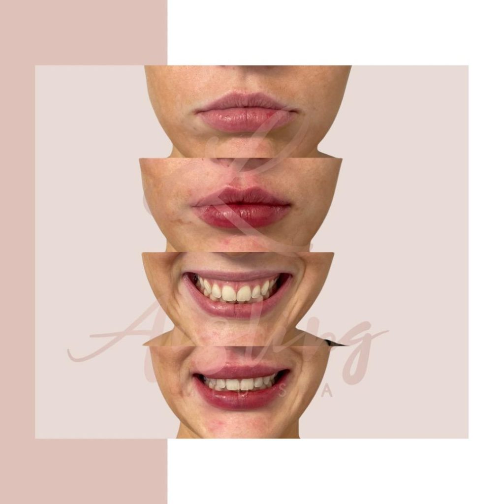 Collage of mouths with varying lip and tooth appearances.