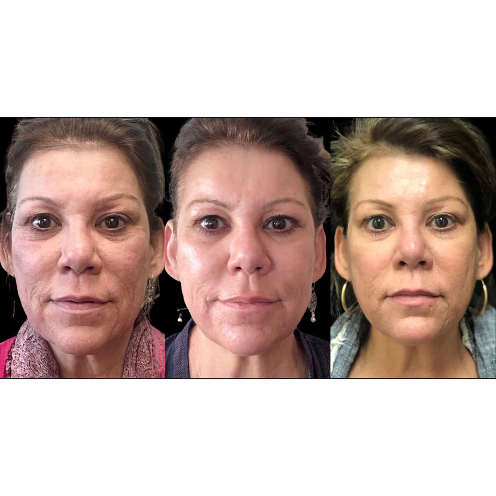 Before and after visuals showing facial transformation over time.