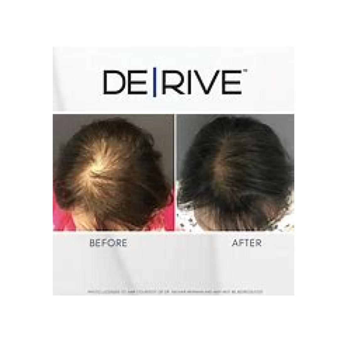 Hair regrowth before and after comparison.